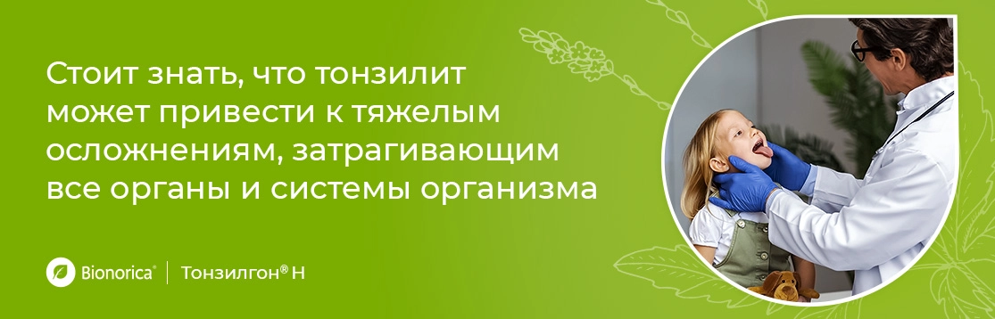 Всегда ли нужно обращаться к врачу при тонзиллите у ребенка?