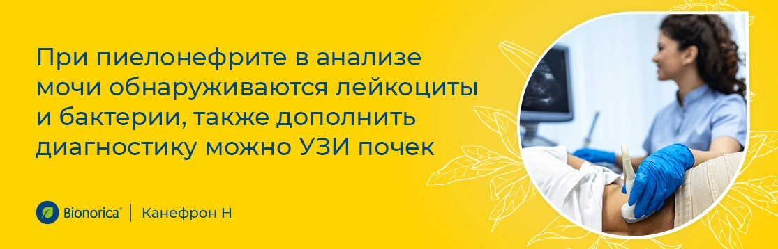 Каковы основные методы диагностики пиелонефрита?