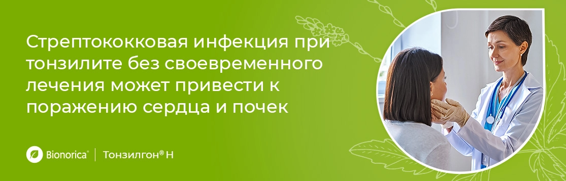 Почему так важно сразу начать лечение острого тонзиллита?